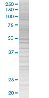 Factor I overexpression 293T lysate (whole cell)