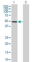 Western blot - Factor I overexpression 293T lysate (whole cell) (AB94092)