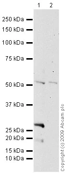 Western blot - Anti-Factor IX/PTC antibody [13B9] - BSA and Azide free (AB17197)