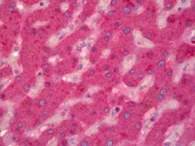 Immunohistochemistry (Formalin/PFA-fixed paraffin-embedded sections) - Anti-Factor IX/PTC antibody (AB128038)