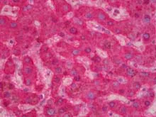 Immunohistochemistry (Formalin/PFA-fixed paraffin-embedded sections) - Anti-Factor IX/PTC antibody (AB128048)