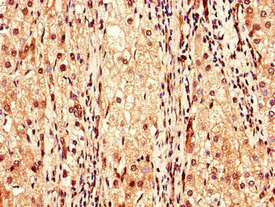 Immunohistochemistry (Formalin/PFA-fixed paraffin-embedded sections) - Anti-Factor IX/PTC antibody (AB236279)