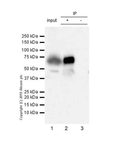 Immunoprecipitation - Anti-Factor IX/PTC antibody [EPR22846-238] (AB255824)
