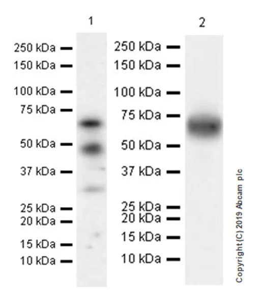 Western blot - Anti-Factor IX/PTC antibody [EPR22846-238] (AB255824)