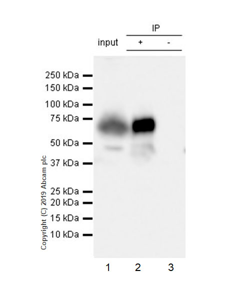 Immunoprecipitation - Anti-Factor IX/PTC antibody [EPR22846-238] - BSA and Azide free (AB256540)