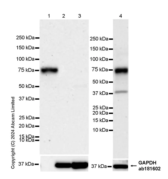 Western blot - Anti-Factor IX/PTC antibody [EPR28007-19] (AB318268)