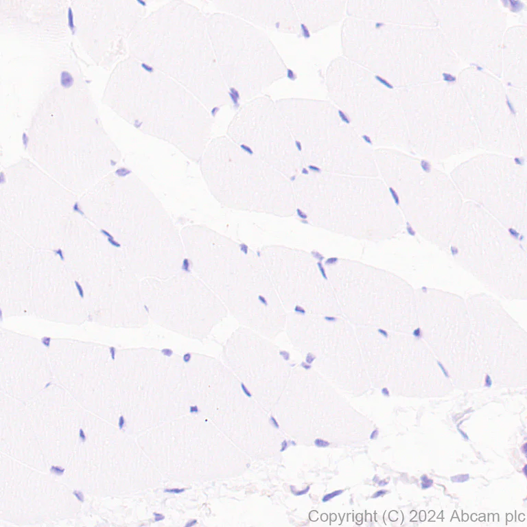 Immunohistochemistry (Formalin/PFA-fixed paraffin-embedded sections) - Anti-Factor IX/PTC antibody [EPR28007-19] - BSA and Azide free (AB318269)