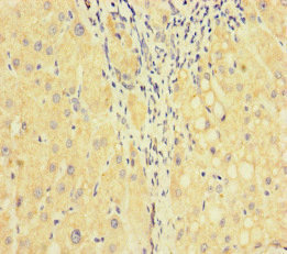 Immunohistochemistry (Formalin/PFA-fixed paraffin-embedded sections) - Anti-Factor V antibody (AB234849)