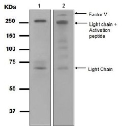 Western blot - Anti-Factor V antibody [EPR5191] (AB108614), expandable thumbnail