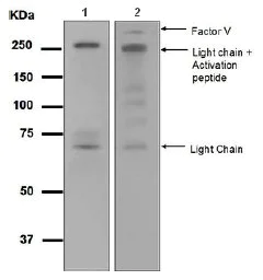 Western blot - Anti-Factor V antibody [EPR5191] (AB108614)