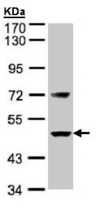 Western blot - Anti-Factor VII antibody (AB97614), expandable thumbnail