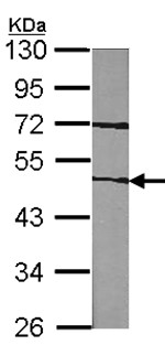 Western blot - Anti-Factor VII antibody (AB97614), expandable thumbnail
