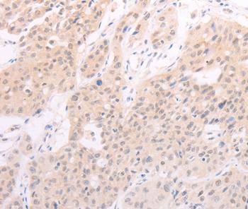 Immunohistochemistry (Formalin/PFA-fixed paraffin-embedded sections) - Anti-Factor VII antibody - C-terminal (AB197656), expandable thumbnail