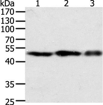 Western blot - Anti-Factor VII antibody - C-terminal (AB197656), expandable thumbnail