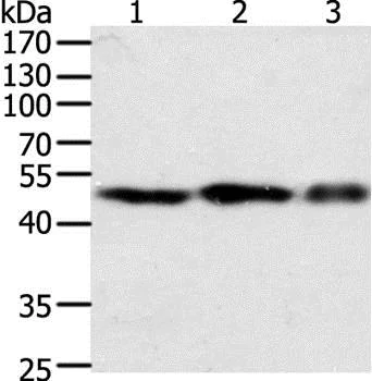 Western blot - Anti-Factor VII antibody - C-terminal (AB197656)