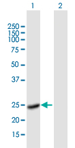 Western blot - Anti-Factor VIII antibody (AB171825)