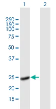 Western blot - Anti-Factor VIII antibody (AB171825)