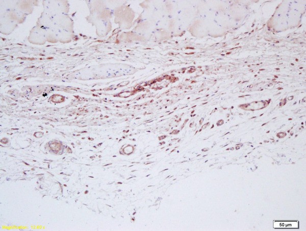 Immunohistochemistry (Formalin/PFA-fixed paraffin-embedded sections) - Anti-Factor VIII antibody (AB203590)