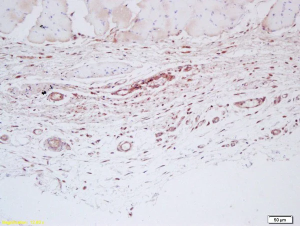 Immunohistochemistry (Formalin/PFA-fixed paraffin-embedded sections) - Anti-Factor VIII antibody (AB203590)