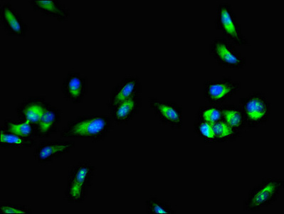 Immunocytochemistry/ Immunofluorescence - Anti-Factor VIII antibody (AB236284)