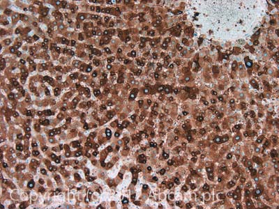 Immunohistochemistry (Formalin/PFA-fixed paraffin-embedded sections) - Anti-Factor VIII antibody [GMA-012] (AB78852)
