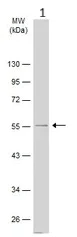 Western blot - Anti-Factor X antibody (AB97632)