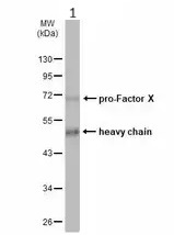 Western blot - Anti-Factor X antibody (AB97632)