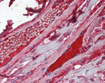 Immunohistochemistry (Formalin/PFA-fixed paraffin-embedded sections) - Anti-Factor Xa Heavy Chain antibody (AB124289)
