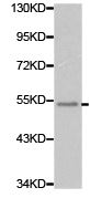 Western blot - Anti-Factor Xa Heavy Chain antibody (AB180701)