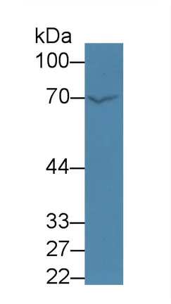 Western blot - Anti-Factor XIa antibody (AB232726)