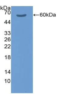 Western blot - Anti-Factor XIa antibody (AB232726)