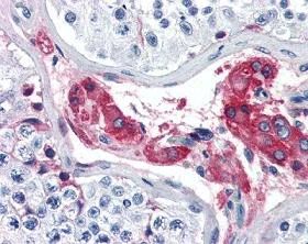 Immunohistochemistry (Formalin/PFA-fixed paraffin-embedded sections) - Anti-Factor XII antibody (AB104557)