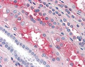 Immunohistochemistry (Formalin/PFA-fixed paraffin-embedded sections) - Anti-Factor XII antibody (AB104557)