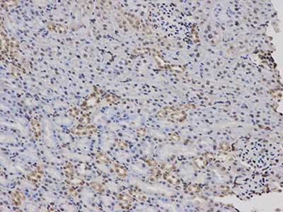 Immunohistochemistry (Formalin/PFA-fixed paraffin-embedded sections) - Anti-Factor XII antibody - C-terminal (AB196670)