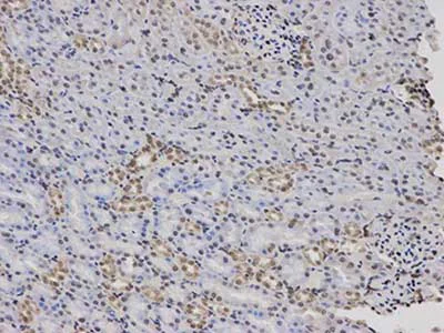 Immunohistochemistry (Formalin/PFA-fixed paraffin-embedded sections) - Anti-Factor XII antibody - C-terminal (AB196670)