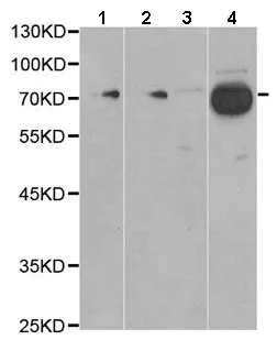 Western blot - Anti-Factor XII antibody - C-terminal (AB196670)