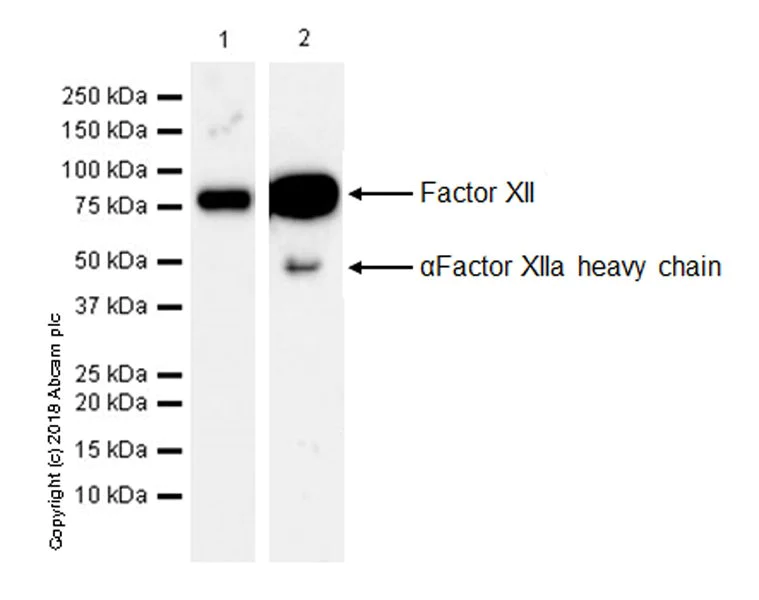 Western blot - Anti-Factor XII antibody [EPR22292-127] (AB242123)