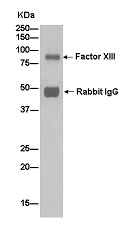 Immunoprecipitation - Anti-Factor XIII antibody [EPR10986(2)] - BSA and Azide free (AB250814), expandable thumbnail