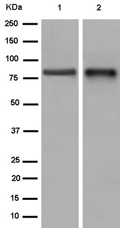 Western blot - Anti-Factor XIII antibody [EPR10986(2)] - BSA and Azide free (AB250814)