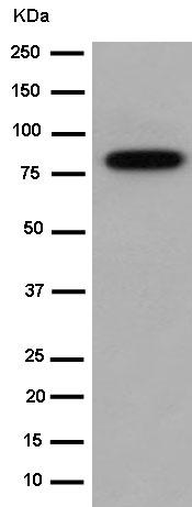 Western blot - Anti-Factor XIII antibody [EPR10986(2)] - BSA and Azide free (AB250814), expandable thumbnail