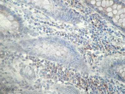 Immunohistochemistry (Formalin/PFA-fixed paraffin-embedded sections) - Anti-Factor XIIIa antibody (AB4057)