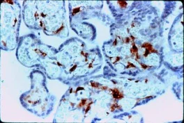 Immunohistochemistry (Formalin/PFA-fixed paraffin-embedded sections) - Anti-Factor XIIIa antibody [AC-1A1] (AB1834)