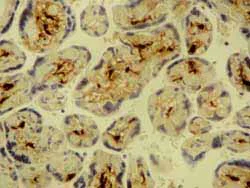Immunohistochemistry (Formalin/PFA-fixed paraffin-embedded sections) - Anti-Factor XIIIa antibody [AC-1A1] (AB1834)