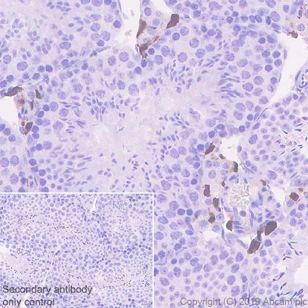 Immunohistochemistry (Formalin/PFA-fixed paraffin-embedded sections) - Anti-Factor XIIIa antibody [EP3372] (AB76105)