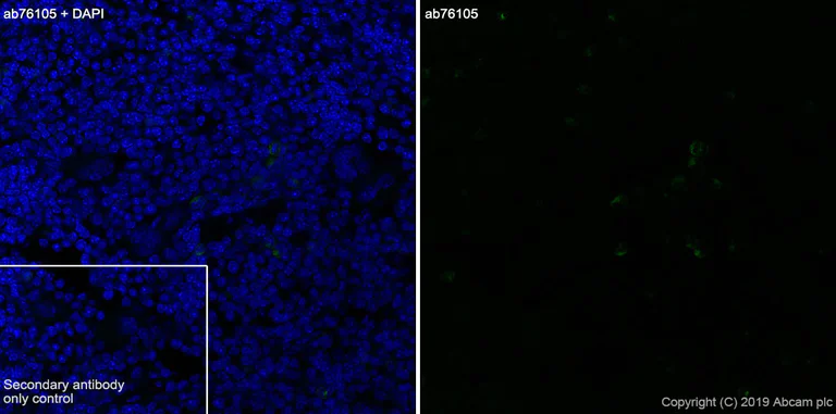 Immunohistochemistry (Frozen sections) - Anti-Factor XIIIa antibody [EP3372] (AB76105)