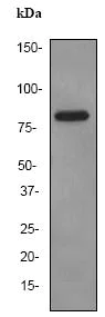 Western blot - Anti-Factor XIIIa antibody [EP3372] (AB76105)