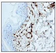 Immunohistochemistry (Formalin/PFA-fixed paraffin-embedded sections) - Anti-Factor XIIIa antibody [EP3372] - BSA and Azide free (AB232426)
