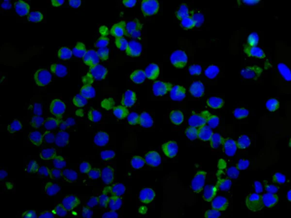 Immunocytochemistry/ Immunofluorescence - Anti-Factor XIIIa antibody [EPR10360] (AB179444)