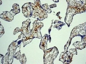 Immunohistochemistry (Formalin/PFA-fixed paraffin-embedded sections) - Anti-Factor XIIIa antibody [EPR10360] (AB179444)