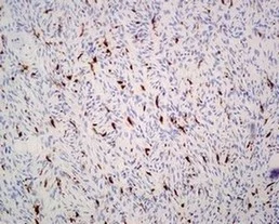 Immunohistochemistry (Formalin/PFA-fixed paraffin-embedded sections) - Anti-Factor XIIIa antibody [EPR10360] (AB179444)